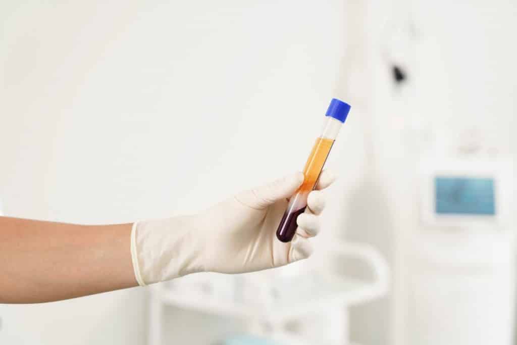 Platelet-Rich Plasma